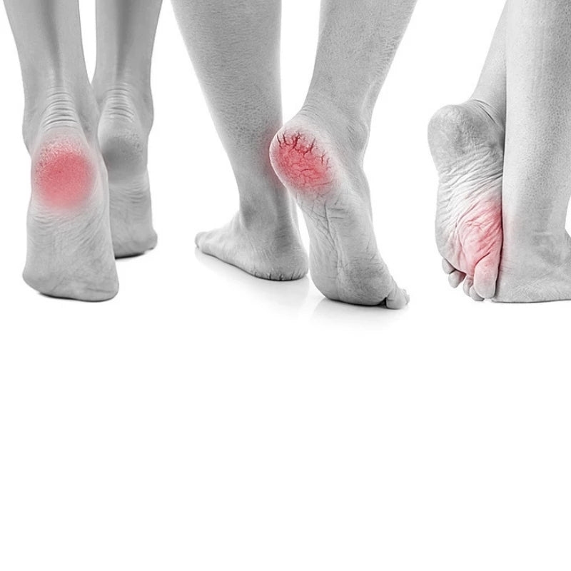 Find Back Callus Remover with Built-in Vacuum – Electric Foot Grinder -  Get deals pk