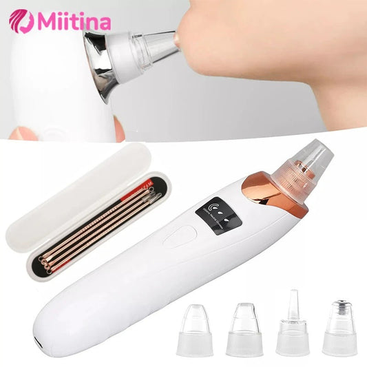 🌟 Blackhead Remover Vacuum – USB Rechargeable Pore Cleaner Kit -  Get deals pk